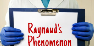 fenomeno o sindrome di raynaud