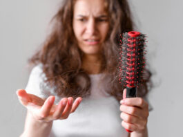 caduta capelli donne